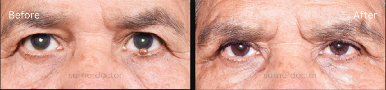 https://drsumerdoctor.com/wp-content/uploads/2026/08/b2.png