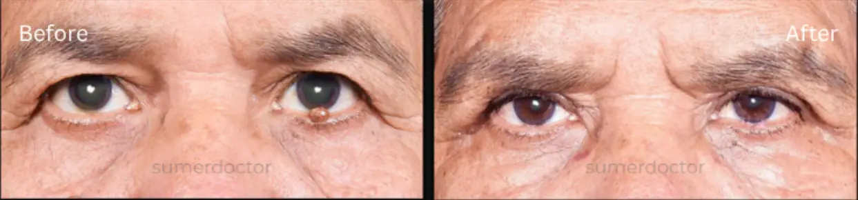 https://drsumerdoctor.com/wp-content/uploads/2026/08/b2.webp