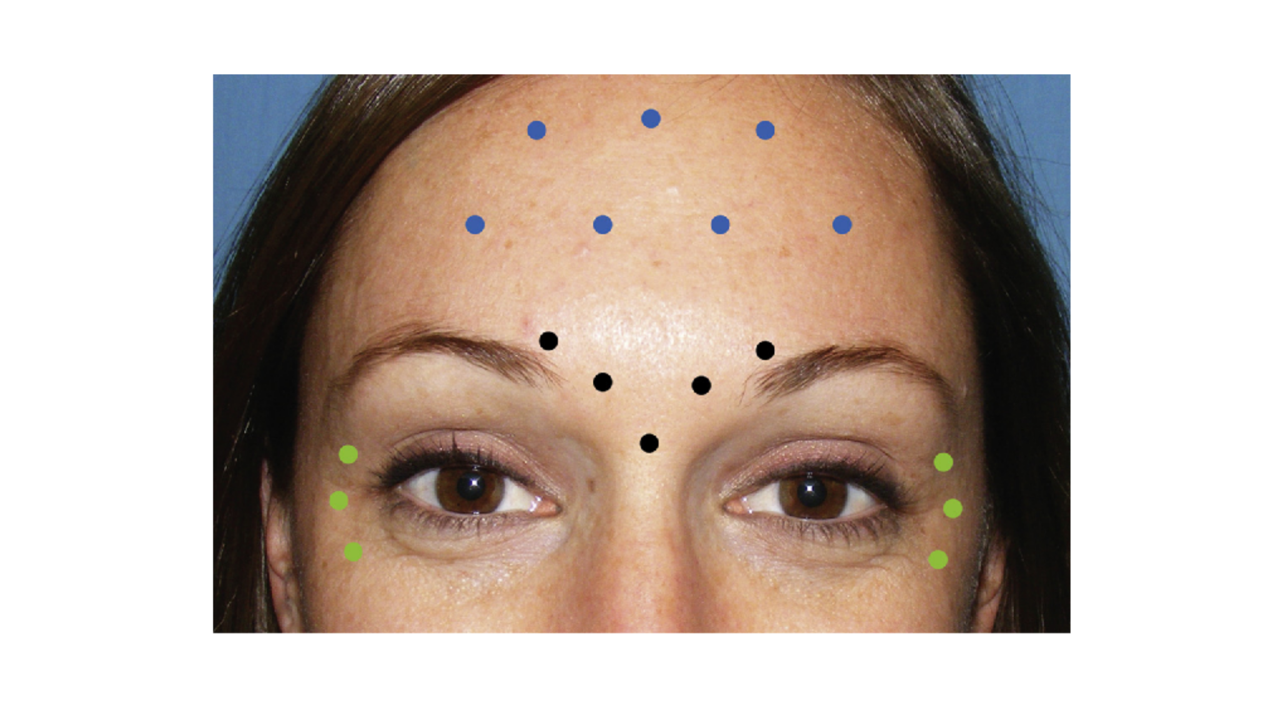 Marking image