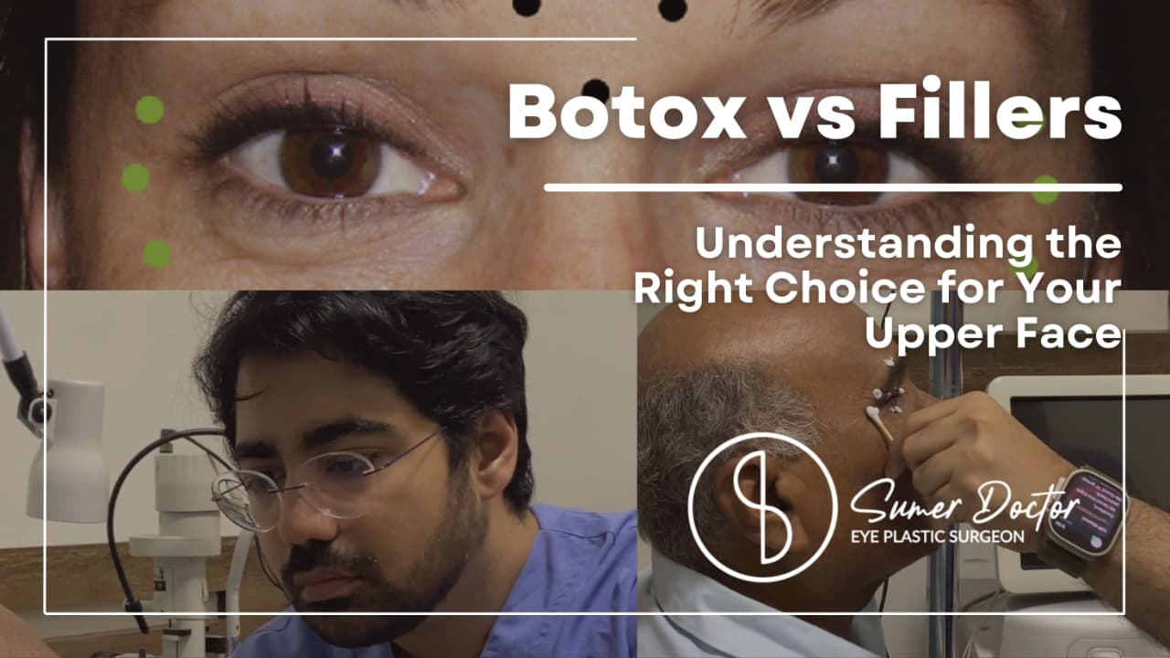 Botox and Fillers for the Upper Face: What’s the Difference and Which One Do You Need?
